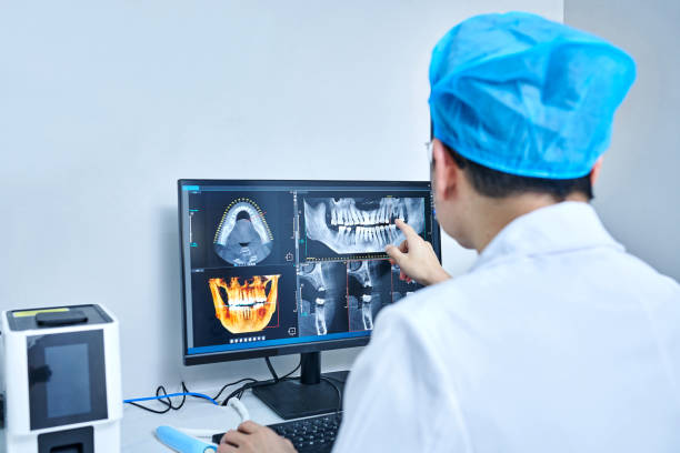 Best Emergency Wisdom Teeth Removal in Wellington, UT
